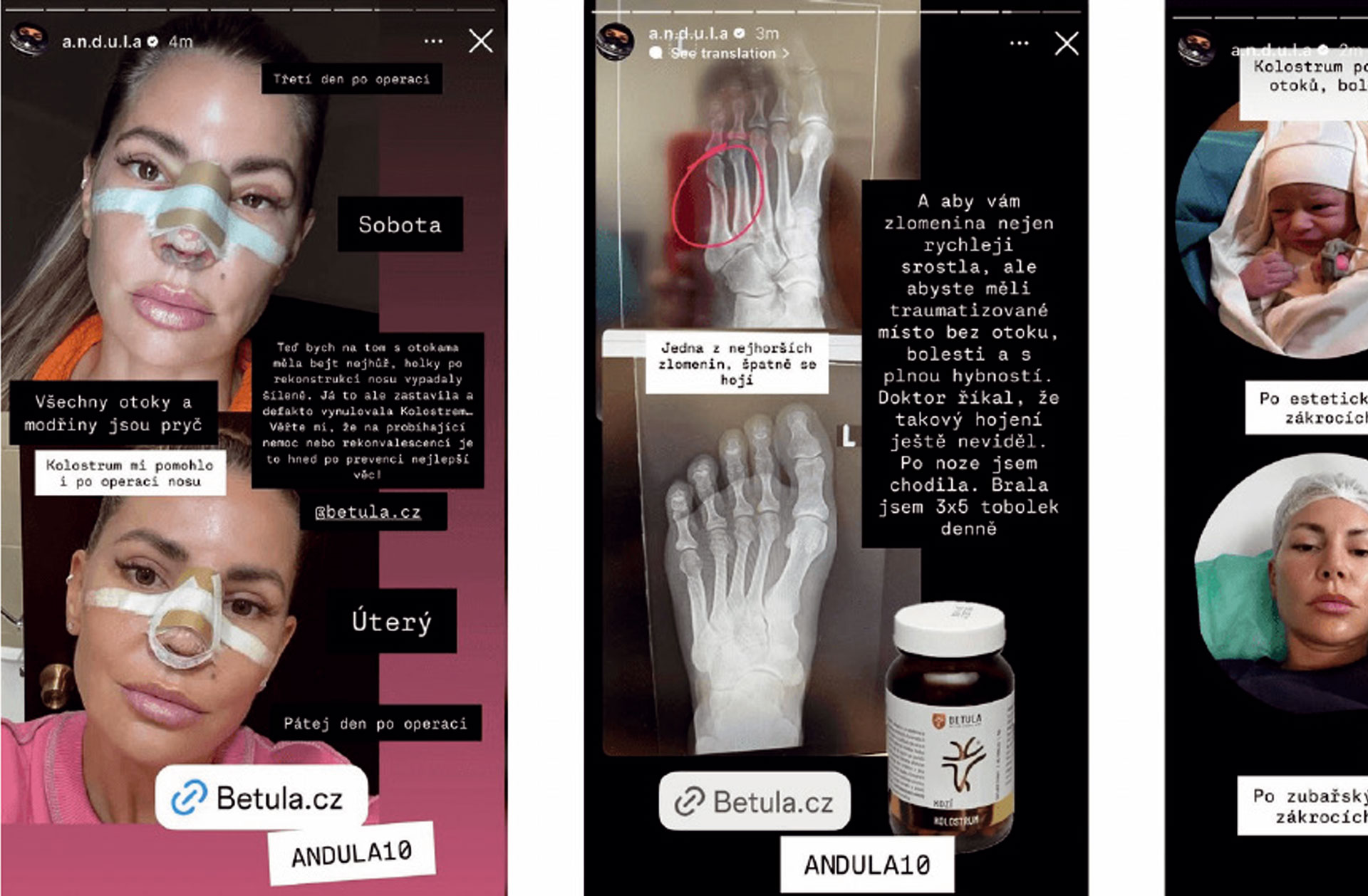 ČLK se připojila ke Kodexu férového influencera